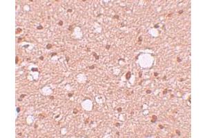 Immunohistochemical staining of human brain cells with APBA2 polyclonal antibody  at 10 ug/mL. (APBA2 抗体  (Internal Region))