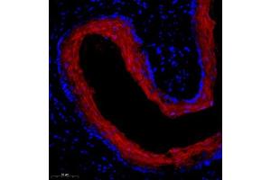 Immunofluorescence of paraffin embedded mouse esophagus using SPRR3 (ABIN7075637) at dilution of 1:2000 (300x lens) (SPRR3 抗体)