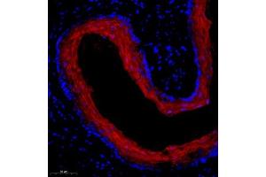 Immunofluorescence of paraffin embedded mouse esophagus using SPRR3 (ABIN7075637) at dilution of 1:2000 (300x lens)