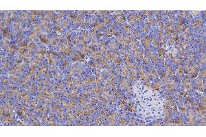 Detection of AMY1A in Human Pancreas Tissue using Polyclonal Antibody to Salivary Alpha Amylase (AMY1A) (Salivary Amylase alpha (AA 15-511) 抗体)