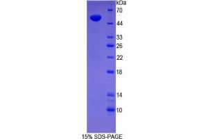 SDS-PAGE analysis of Human Synaptopodin Protein. (SYNPO 蛋白)