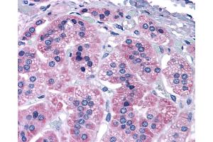 Anti-GRM7 / MGLUR7 antibody IHC of human adrenal. (GRM7 抗体  (N-Term))