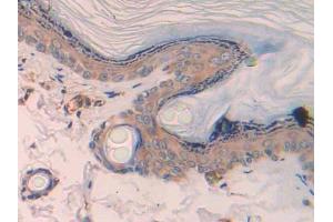 Used in DAB staining on fromalin fixed paraffin- embedded skeletal muscle tissue (CCL4 抗体  (AA 24-92))