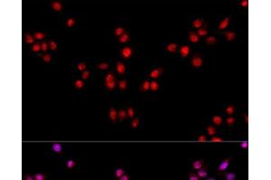 Immunofluorescence analysis of HeLa cells using ESRRA Polyclonal Antibody at dilution of 1:100. (ESRRA 抗体)