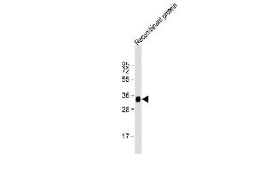Anti-LRP1B Antibody at 1:2000 dilution + Recombinant protein Lysates/proteins at 20 μg per lane.