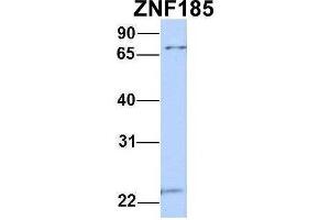 Host:  Rabbit  Target Name:  ZNF185  Sample Type:  MCF7  Antibody Dilution:  1. (Zinc Finger Protein 185 抗体  (N-Term))