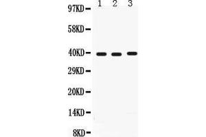 Anti-Midkine antibody, Western blotting All lanes: Anti Midkine  at 0. (Midkine 抗体  (AA 21-143))