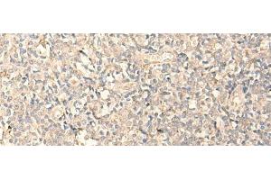 Immunohistochemistry of paraffin-embedded Human tonsil tissue using MPPED2 Polyclonal Antibody at dilution of 1:25(x200) (MPPED2 抗体)