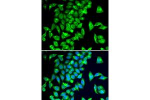 Immunofluorescence analysis of A549 cells using TPH2 antibody (ABIN5974298). (Tryptophan Hydroxylase 2 抗体)