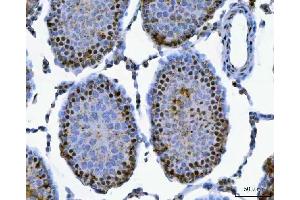 IHC analysis of SAP130 using anti-SAP130 antibody (ABIN7601247).