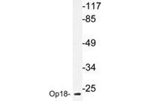 Western blot analyzes of Op18 antibody in extracts from COLO205 cells. (Stathmin 1 抗体)