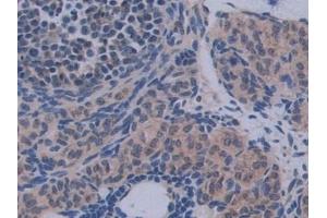Immunohistochemistry (IHC) image for anti-Interleukin 12 alpha (IL12A) (AA 23-215) antibody (ABIN7430654)