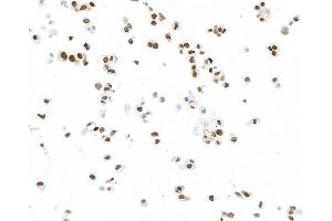 Immunocytochemistry (ICC) image for anti-Paired Box 8 (PAX8) antibody (ABIN7795602)