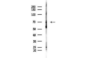 anti-Ezrin (EZR) (C-Term) antibody