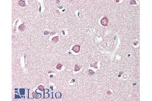 ABIN1590128 (5µg/ml) staining of paraffin embedded Human Cortex. (ENPP2 抗体  (AA 698-712))