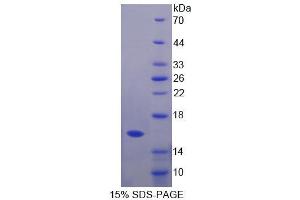 SDS-PAGE analysis of Mouse GHRH Protein. (GHRH 蛋白)
