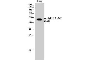 Western Blotting (WB) image for anti-Eukaryotic Translation Elongation Factor 1 Alpha1/Alpha2 (EF-1 Alpha1/2) (acLys41) antibody (ABIN3180430) (EF-1 Alpha1/2 抗体  (acLys41))