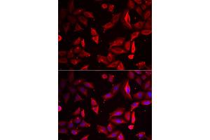 Immunofluorescence analysis of HeLa cells using SERPINB9 antibody. (SERPINB9 抗体)
