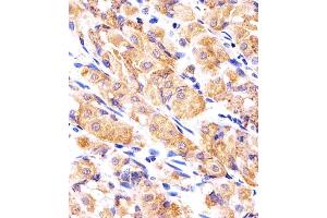 Immunohistochemical analysis of paraffin-embedded H. (RPLP0P6 抗体  (N-Term))
