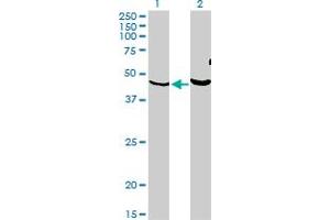 Western Blot analysis of PKNOX1 expression in transfected 293T cell line by PKNOX1 monoclonal antibody (M05), clone 2B3. (PKNOX1 抗体  (AA 2-100))