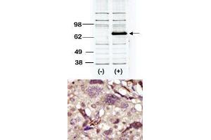 Image no. 2 for anti-Bruton Agammaglobulinemia tyrosine Kinase (BTK) (Middle Region) antibody (ABIN359974) (BTK 抗体  (Middle Region))
