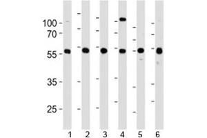 YY1 antibody western blot analysis in 1) 293, 2) HL-60, 3) SiHa, 4) K562, 5) THP-1 and 6) U266 lysate. (YY1 抗体  (AA 74-104))