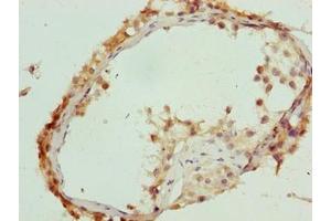 Immunohistochemistry of paraffin-embedded human testis tissue using ABIN7174755 at dilution of 1:100 (C17orf64 抗体  (AA 111-236))
