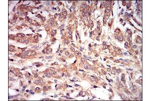 Immunohistochemistry (IHC) image for anti-Protein Kinase, AMP-Activated, gamma 1 Non-Catalytic Subunit (PRKAG1) (AA 230-331) antibody (ABIN1724932)