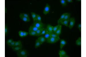 Immunofluorescence staining of HepG2 cells with ABIN7160369 at 1:133, counter-stained with DAPI. (MKLN1 抗体  (AA 488-614))