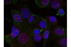 Immunofluorescence staining of methanol-fixed Hela cells using Rel(Phospho-Ser503) Antibody. (c-Rel 抗体  (pSer503))