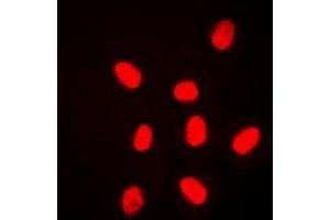 Immunofluorescent analysis of ERK3 staining in HeLa cells. (MAPK6 抗体  (Center))
