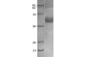 Western Blotting (WB) image for Butyrophilin, Subfamily 1, Member A1 (BTN1A1) protein (GST tag) (ABIN2715353)