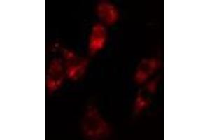 ABIN6279766 staining Hela cells by IF/ICC. (ARHGAP12 抗体  (Internal Region))
