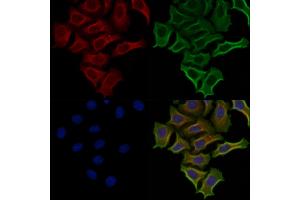 ABIN6257930 and ABIN6274821 staining Hela cells by IF/ICC.
