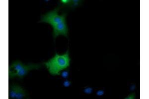 Anti-QPRT mouse monoclonal antibody (ABIN2453570) immunofluorescent staining of COS7 cells transiently transfected by pCMV6-ENTRY QPRT (RC202960). (QPRT 抗体)