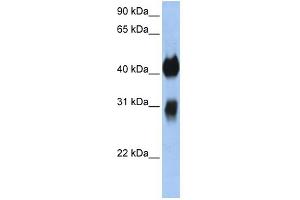 WB Suggested Anti-OTX1 Antibody Titration:  0. (OTX1 抗体  (C-Term))