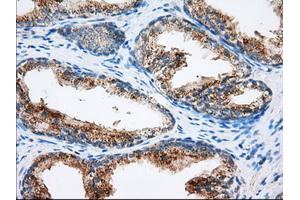 Immunohistochemical staining of paraffin-embedded liver tissue using anti-MTRF1L mouse monoclonal antibody. (MTRF1L 抗体)