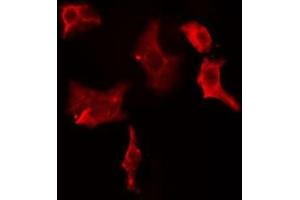 ABIN6274964 staining HeLa cells by IF/ICC. (CBR1 抗体  (C-Term))