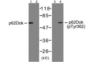 Western blot analysis of extracts from Jurkat cells, using p62Dok (Ab-362) antibody (E021268, Line 1 and 2) and p62Dok (phospho-Tyr362) antibody (E011276, Line 3 and 4). (DOK1 抗体  (pTyr362))