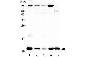 Western blot testing of human 1) U-87 MG, 2) MCF7, 3) A549, 4) HepG2 and 5) mouse testis lysate with DYNLT1 antibody at 0. (DYNLT1 抗体)
