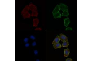 ABIN6257862 and ABIN6275231 staining Hela cells(30 min of UV treatment) by IF/ICC. (MAP9 抗体  (N-Term))