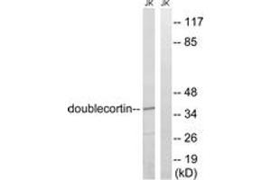 Western blot analysis of extracts from Jurkat cells, using Doublecortin (Ab-376) Antibody. (Doublecortin 抗体  (AA 346-395))