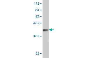 Western Blot detection against Immunogen (37. (Transglutaminase 7 抗体  (AA 466-565))