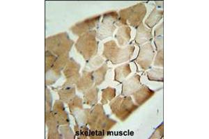 CDKN2C Antibody immunohistochemistry analysis in formalin fixed and paraffin embedded human skeletal muscle followed by peroxidase conjugation of the secondary antibody and DAB staining. (CDKN2C 抗体  (C-Term))