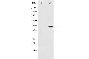 Western blot analysis of IKK- gamma phosphorylation expression in TNF-a treated 293 whole cell lysates,The lane on the left is treated with the antigen-specific peptide.