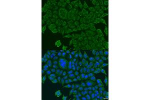 Immunofluorescence analysis of U2OS cells using BCS1L antibody (ABIN2736351) at dilution of 1:100. (BCS1L 抗体)
