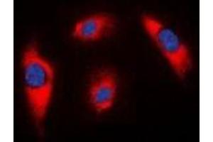 Immunofluorescent analysis of MRPS18C staining in K562 cells. (MRPS18C 抗体)