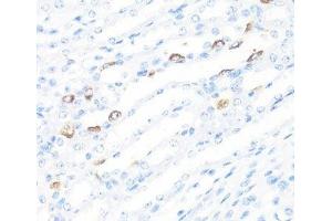 Immunohistochemistry of paraffin-embedded Mouse kidney using FGF10 Polyclonal Antibody at dilution of 1:100 (40x lens). (FGF10 抗体)