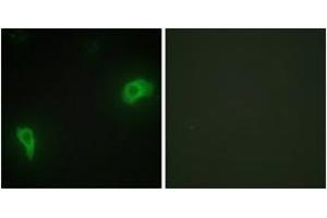 Immunofluorescence analysis of HepG2 cells, using DOK7 Antibody. (DOK7 抗体  (AA 10-59))