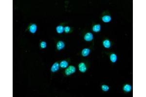 IF analysis of CENPB using anti-CENPB antibody (ABIN7602867). (CENPB 抗体  (C-Term))